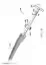 Fig. 15 - Inside-out guide for hip replacement method