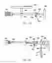 Fig. 16 - Inside-out guide for hip replacement method