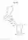 Fig. 04 - Surgical system for positioning prosthetic component and/or for constraining movement of surgical tool