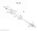 Fig. 09 - Surgical system for positioning prosthetic component and/or for constraining movement of surgical tool