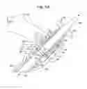 Fig. 11 - Surgical system for positioning prosthetic component and/or for constraining movement of surgical tool