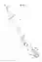 Fig. 17 - Surgical system for positioning prosthetic component and/or for constraining movement of surgical tool