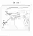 Fig. 25 - Surgical system for positioning prosthetic component and/or for constraining movement of surgical tool