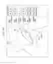 Fig. 35 - Surgical system for positioning prosthetic component and/or for constraining movement of surgical tool
