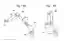 Fig. 40 - Surgical system for positioning prosthetic component and/or for constraining movement of surgical tool