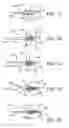 Fig. 02 - Methods and apparatus for intervertebral disc prosthesis insertion