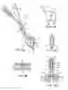 Fig. 05 - Methods and apparatus for intervertebral disc prosthesis insertion