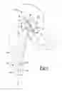 Fig. 02 - Trial prosthesis system