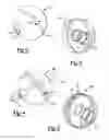 Fig. 03 - Trial prosthesis system