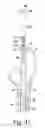 Fig. 19 - Version-replicating instrument and orthopaedic surgical procedure for using the same to implant a revision hip prosthesis