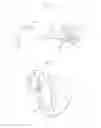 Fig. 03 - External breast prosthesis