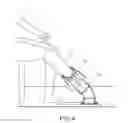 Fig. 05 - Alignment device for a prosthetic leg liner pin