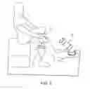 Fig. 08 - Alignment device for a prosthetic leg liner pin