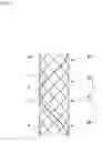 Fig. 02 - STENT AND METHOD FOR MANUFACTURING STENT