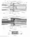 Fig. 02 - Scaffold loading and delivery systems