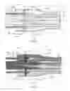 Fig. 03 - Scaffold loading and delivery systems