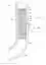 Fig. 01 - Multiple stent system for GI tract drainage