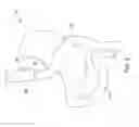 Fig. 03 - Multiple stent system for GI tract drainage
