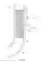 Fig. 17 - Multiple stent system for GI tract drainage