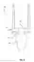 Fig. 10 - Elastic brace assembly and methods of use