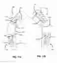 Fig. 19 - Elastic brace assembly and methods of use