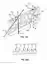 Fig. 23 - Elastic brace assembly and methods of use