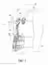 Fig. 02 - Thoracic lumbar sacral orthosis