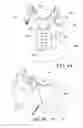 Fig. 07 - Thoracic lumbar sacral orthosis