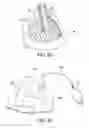 Fig. 09 - Thoracic lumbar sacral orthosis