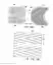 Fig. 08 - TONGUE GRASPING AND RESTRAINING APPARATUS AND METHODS