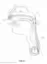 Fig. 07 - Devices And Methods For Treating Sleep Disordered Breathing