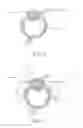Fig. 04 - System and method for the delivery of medications or fluids to the eye