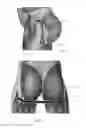 Fig. 03 - DIAPER