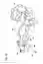 Fig. 30 - Orthosis for range of motion