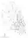 Fig. 18 - Methods and apparatus for adjusting blood circulation