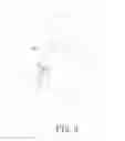 Fig. 04 - TRUNCATED FEEDING TUBE