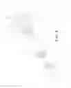Fig. 05 - TRUNCATED FEEDING TUBE