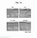 Fig. 06 - Composition for improving skin conditions, containing chlorophyll a or pheophorbide a