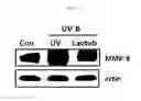 Fig. 06 - COMPOSITION, CONTAINING TYNDALLIZED LACTOBACILLUS DEAD CELLS AS ACTIVE INGREDIENT, FOR SKIN MOISTURIZING OR WRINKLE IMPROVEMENT