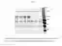Fig. 02 - PROLYL HYDROXYLASE INHIBITORS AND METHODS OF USE