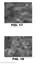 Fig. 11 - ANTIMICROBIAL COMPOSITIONS AND METHODS OF USE
