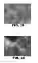 Fig. 12 - ANTIMICROBIAL COMPOSITIONS AND METHODS OF USE