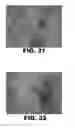 Fig. 18 - ANTIMICROBIAL COMPOSITIONS AND METHODS OF USE
