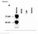 Fig. 14 - MESENCHYMAL STEM CELL PARTICLES