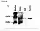 Fig. 16 - MESENCHYMAL STEM CELL PARTICLES