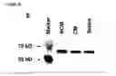 Fig. 18 - MESENCHYMAL STEM CELL PARTICLES