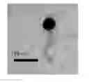 Fig. 01 - Bacteriophage and composition comprising same