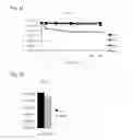 Fig. 04 - Bacteriophage and composition comprising same