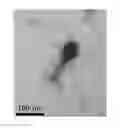 Fig. 01 - Bacteriophage and composition comprising same