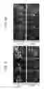 Fig. 09 - Compositions and methods for treating fibrosis